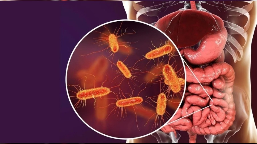 Erken Tan� ile %90 Sa� Kal�m: Kolon Kanserinde ����r A�an Ger�ek