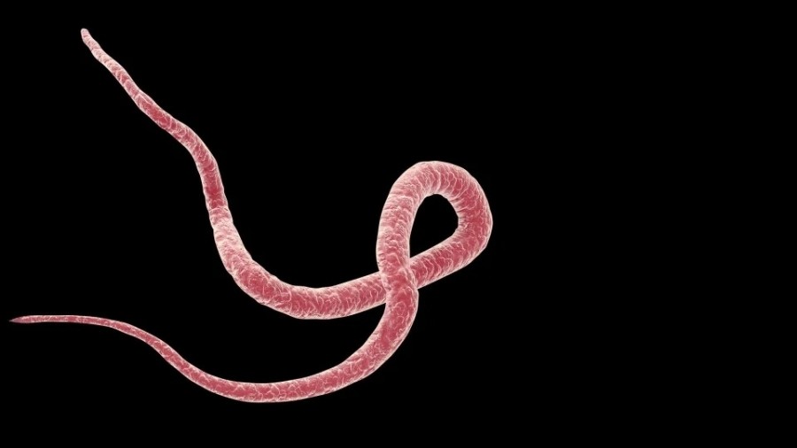 Az pi�mi� et, iyi y�kanmam�� sebze sizi g�z�n�zden edebilir