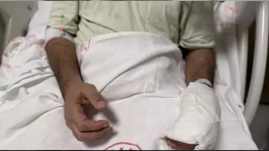 Herkesin Evindeki Tehlike! V�cudunun Y�zde 30'u Yand�