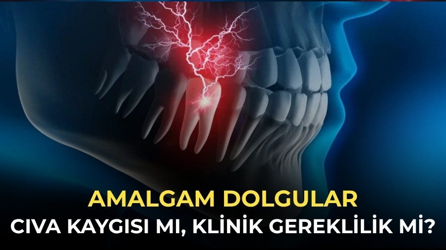 Amalgam Dolgular: C�va Kayg�s� m�, Klinik Gereklilik mi?