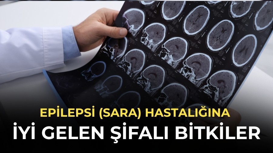 Epilepsi (Sara) Hastal���na iyi gelen �ifal� bitkiler